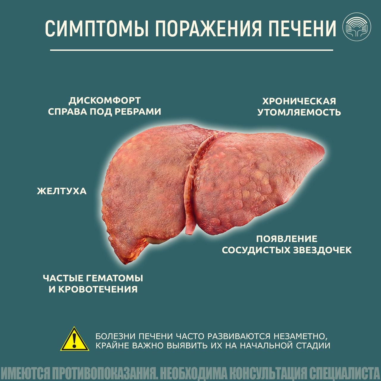 Симптомы поражения печени Симптомы поражения печени