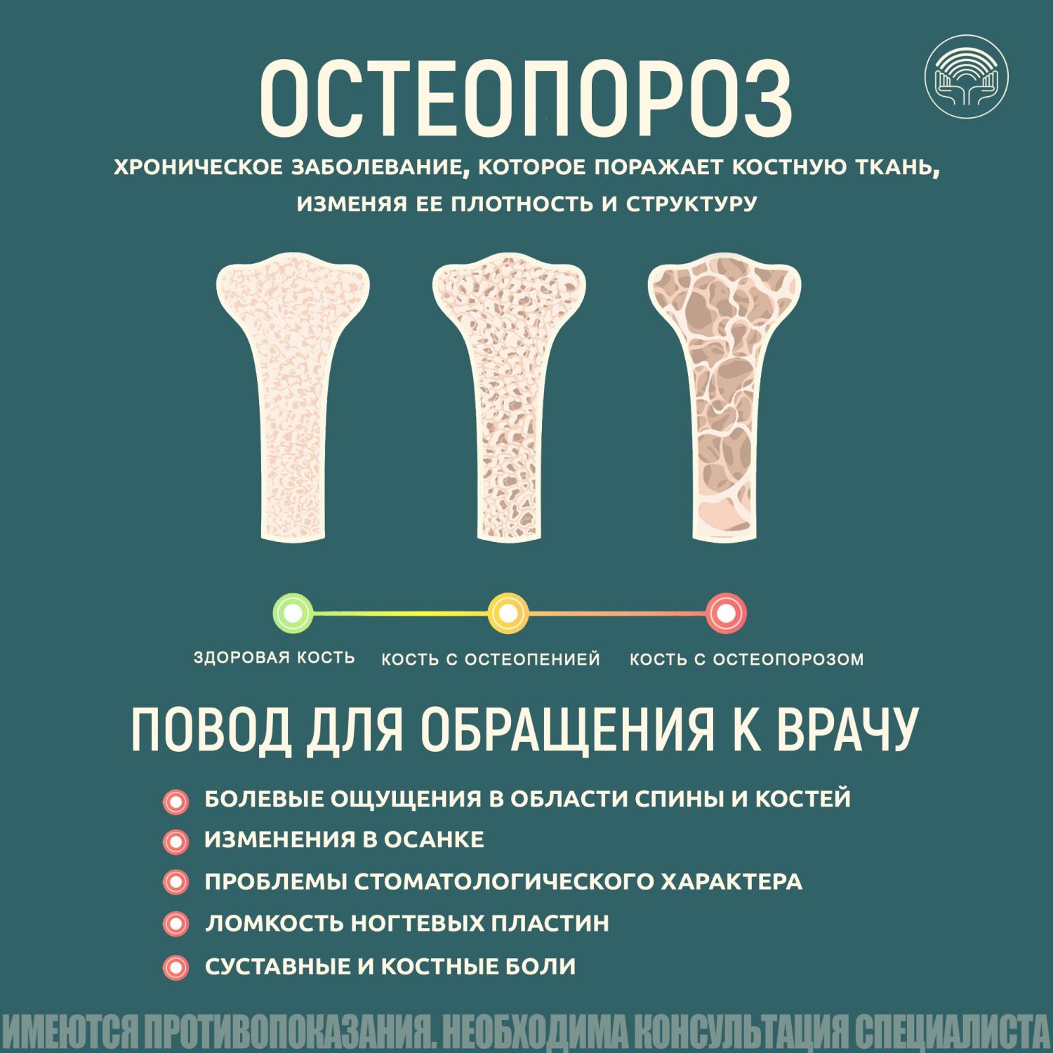 Остеопороз Остеопороз